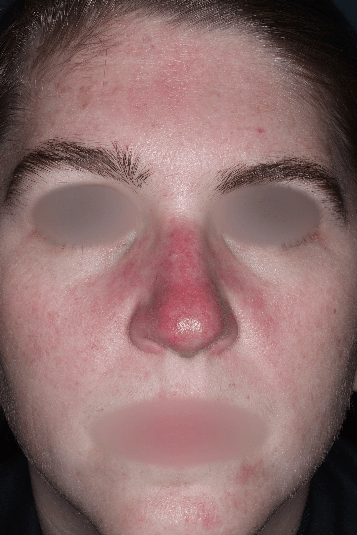 Patient C After